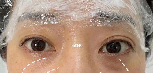 黑眼圈眼袋告别秘籍，重拾明亮双眸（通过有效方法去除黑眼圈和眼袋，让双眸恢复亮丽光彩）