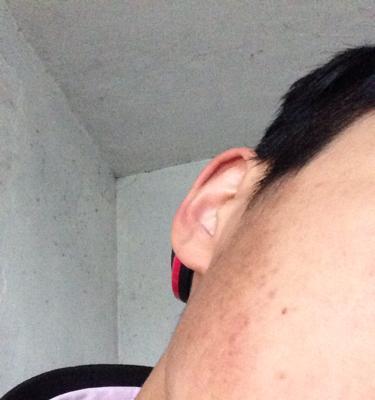 手机夜间拍照时脸部发黑如何修复？修复后照片效果如何？