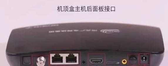 路由器哪个端口连接顶盒最好？