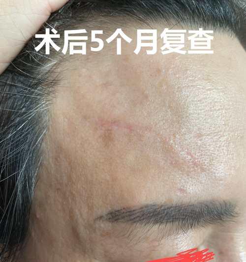 相机镜头边磕了的修复方法是什么？修复后会影响使用吗？