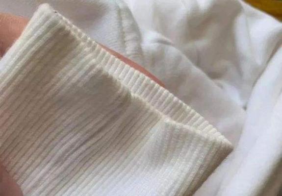 白色电脑表面发黄如何清理？有效清洁方法有哪些？